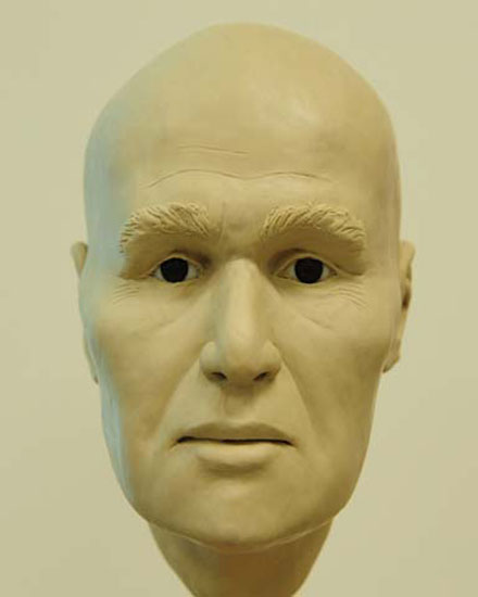 Photo of facial reconstruction