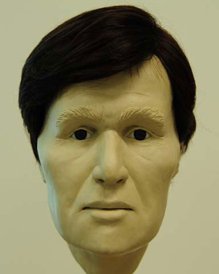 Photo of facial reconstruction