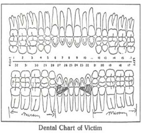 Dental Chart