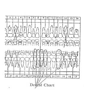 Photo of Dental Chart